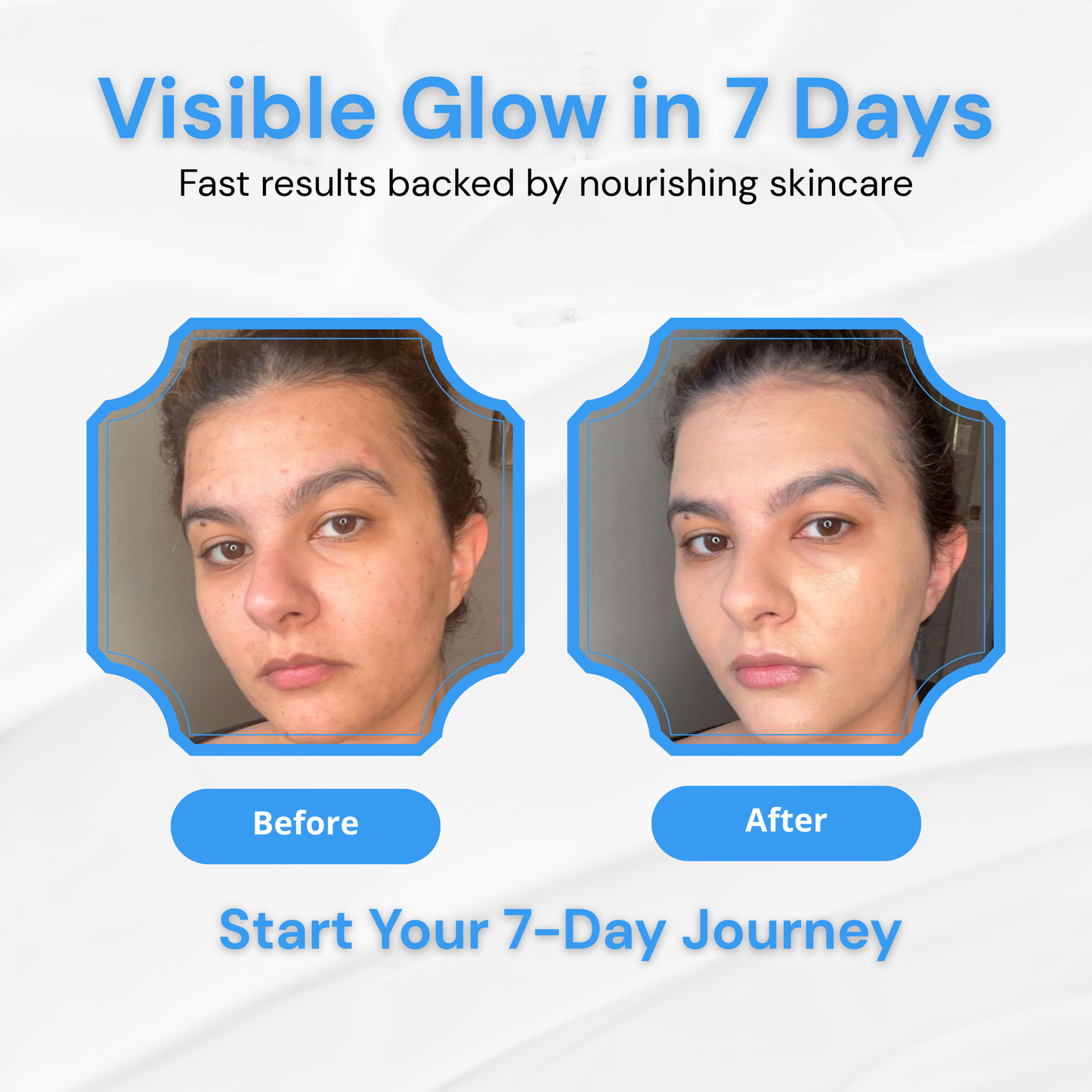 Skindrai Glow+ SPF 60 Moisturizer