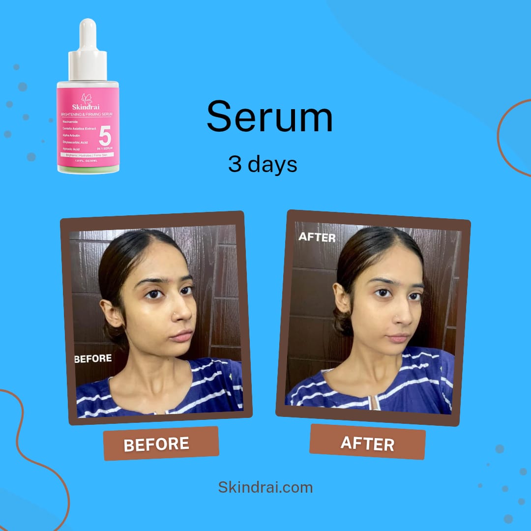 Brightening & Firming 5-in-1 Serum